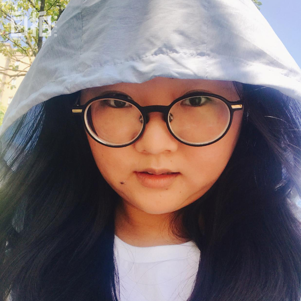 鍏堝ぉ鎬уけ鑱墜鏈垂澶氬皯,澶辫仾鎵嬫湳鎭㈠鍚姏