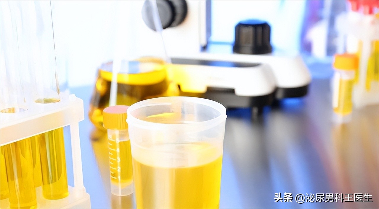 排尿很黄、异味很大？身体向你暗示的这3件事，可能与疾病有关