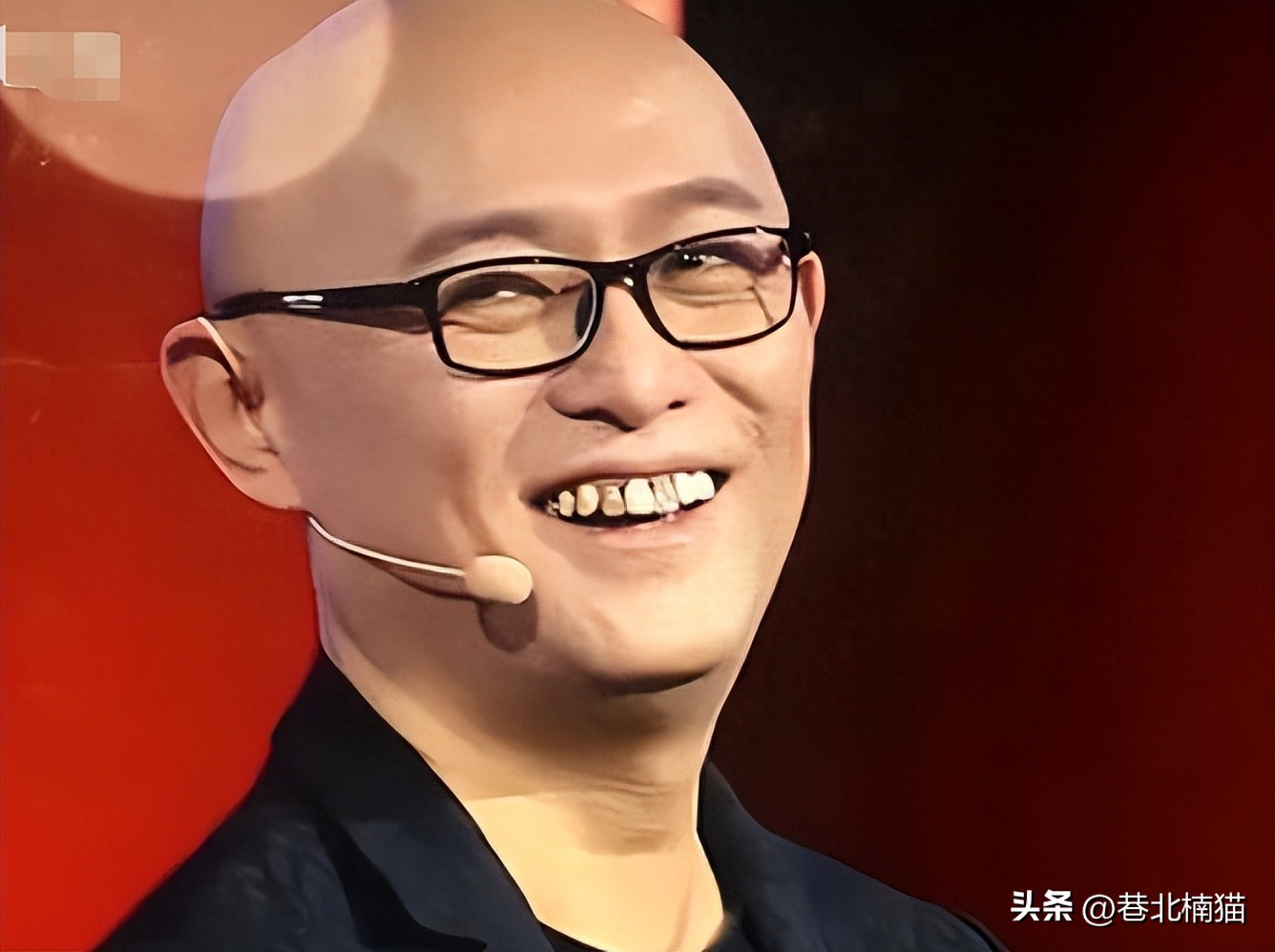 明星嘴突戴牙套前后对比,明星和假牙