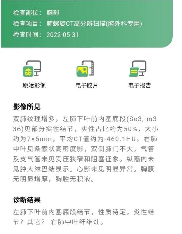 肾癌切除后七年发现软组织结节,肾癌切除后发现结节