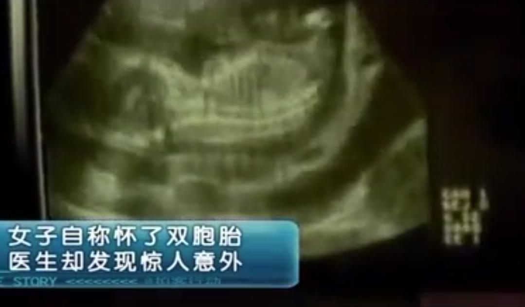 女子刚出月子又怀孕,女子醒来发现肚子里孩子没了