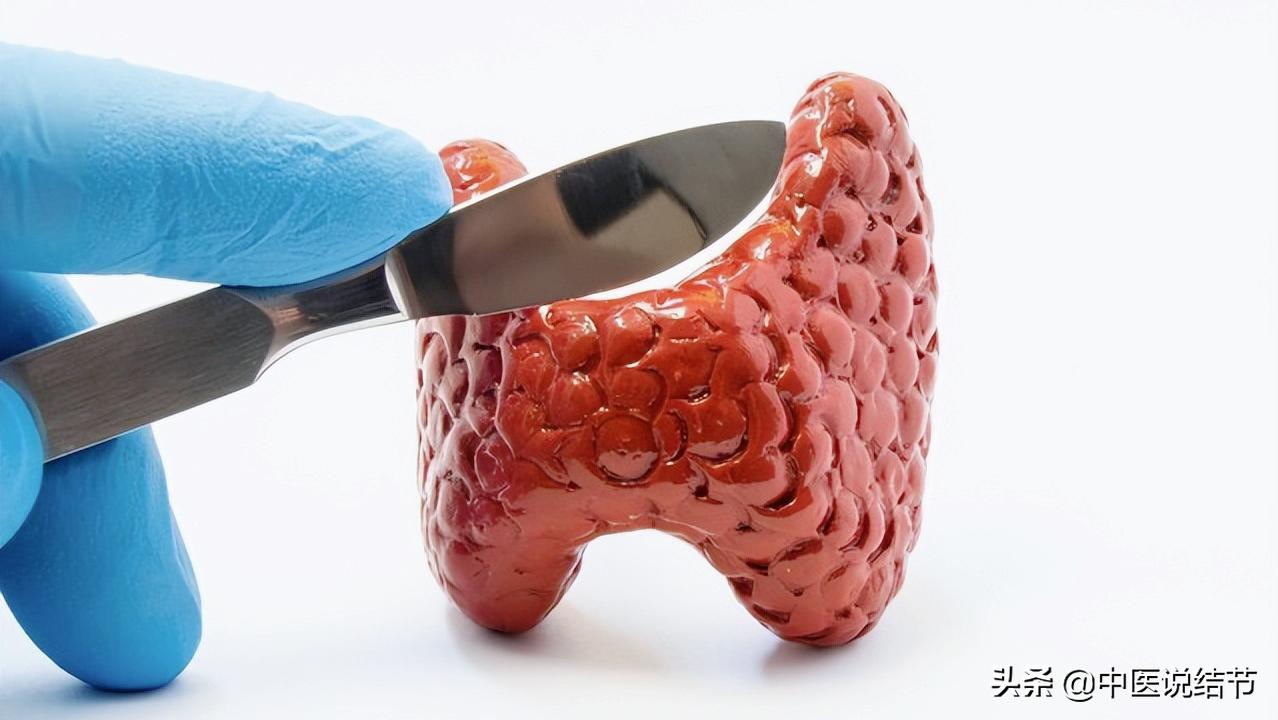 治疗甲状腺结节的3种常用方法，怎样选择？分别有哪些表现？