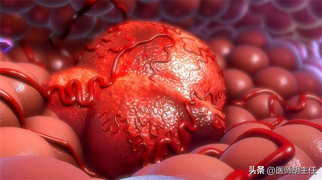 宫颈癌的前兆会不会腿痛,宫颈癌有一项异常会怎样