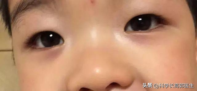 孩子瘦吃饭也不长怎么办,儿童体质弱不长肉怎么办