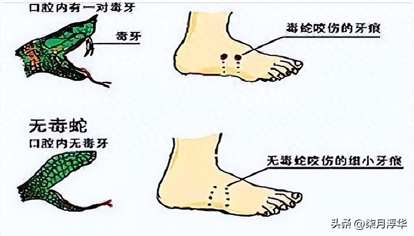 贵州男子被“剧毒银环蛇”咬伤，提蛇去就医，医生看后长舒一口气