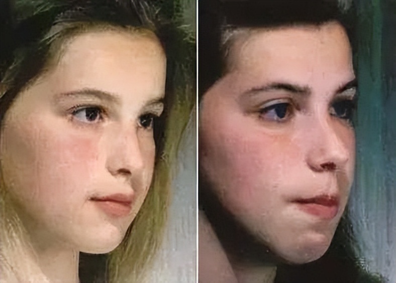 杨颖凸嘴分析,显老显凶嘴凸