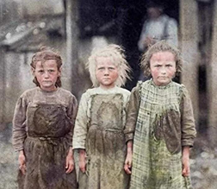 世界上嘴最大的女人,世界上最大嘴的女人