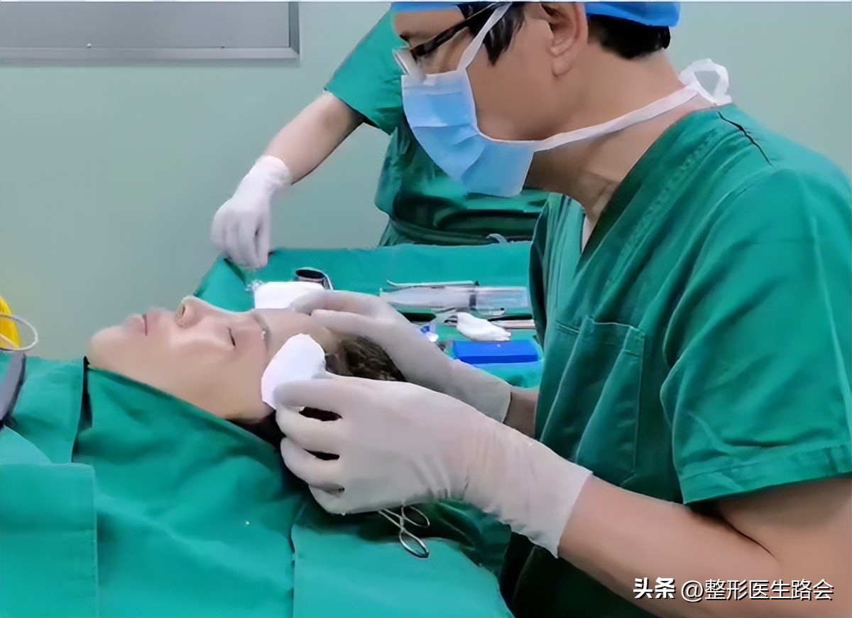 上海九院膨体填充太阳穴费用多少,膨体丰太阳穴视频全过程