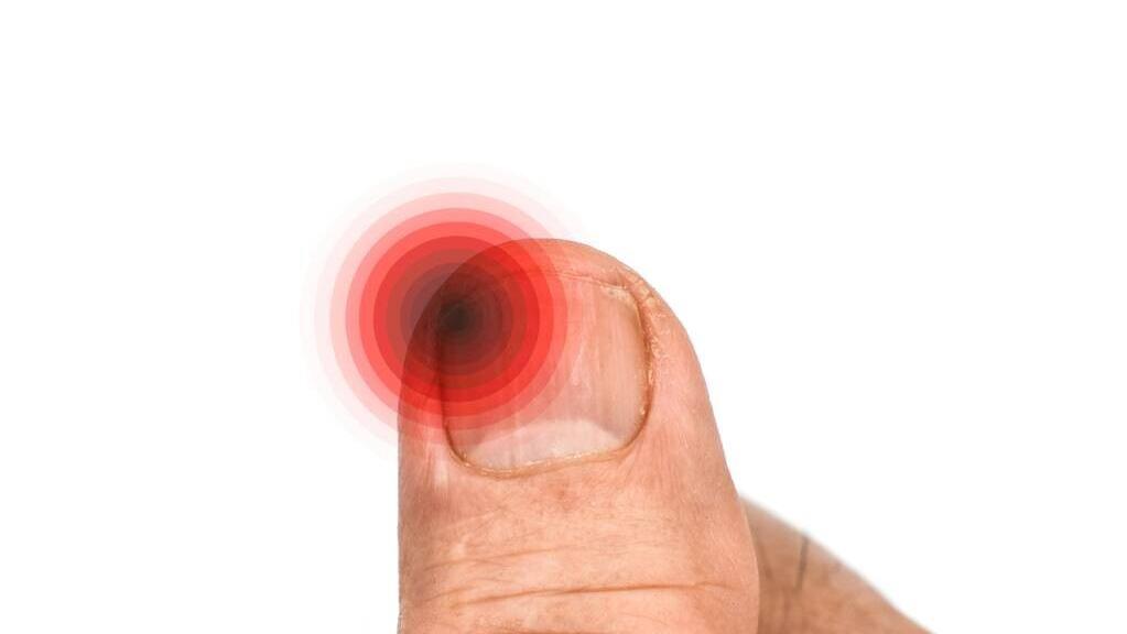 脚趾甲老是往肉里抠,脚趾甲一碰就疼怎么解决