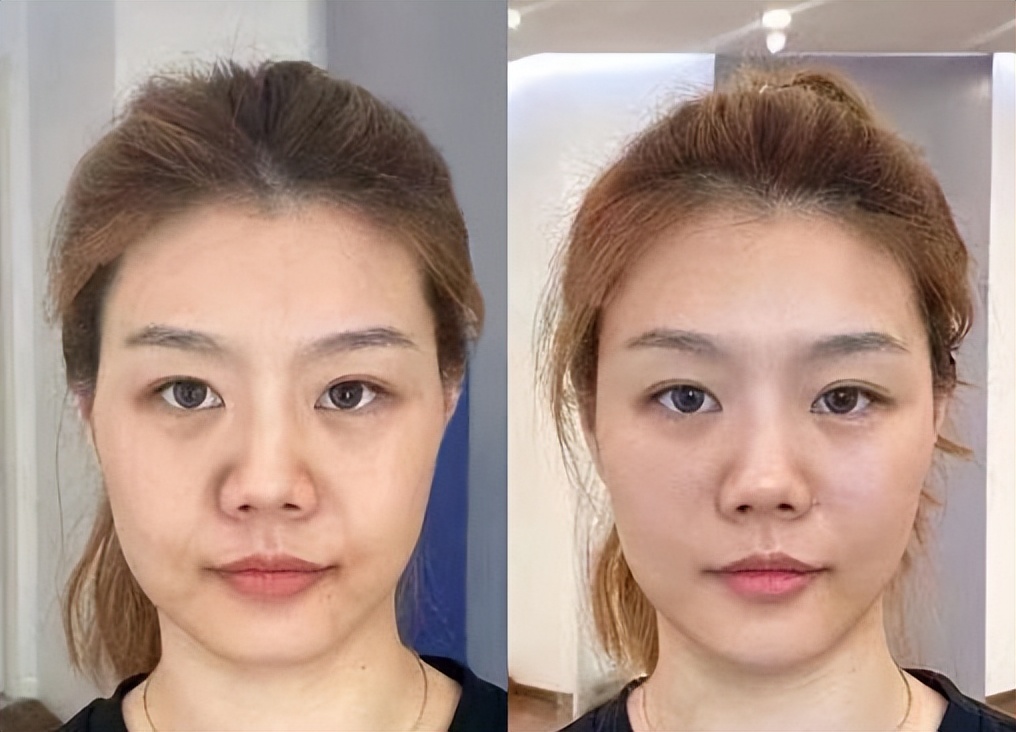 拯救垮脸秘籍,垮脸自救