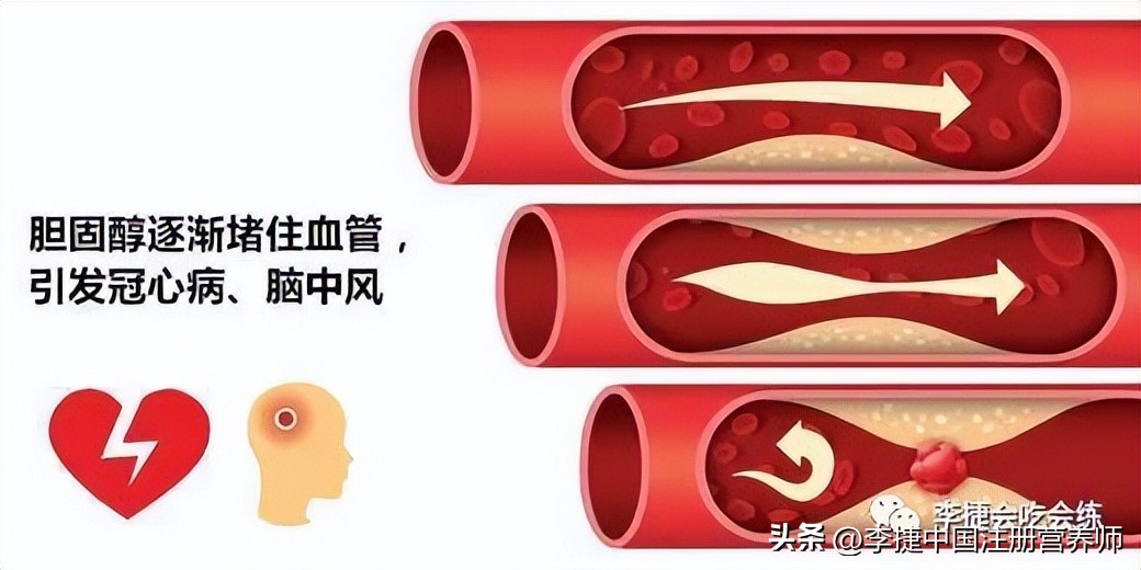 如何提高高密度脂蛋白胆固醇数值,如何才能提高高密度脂蛋白胆固醇