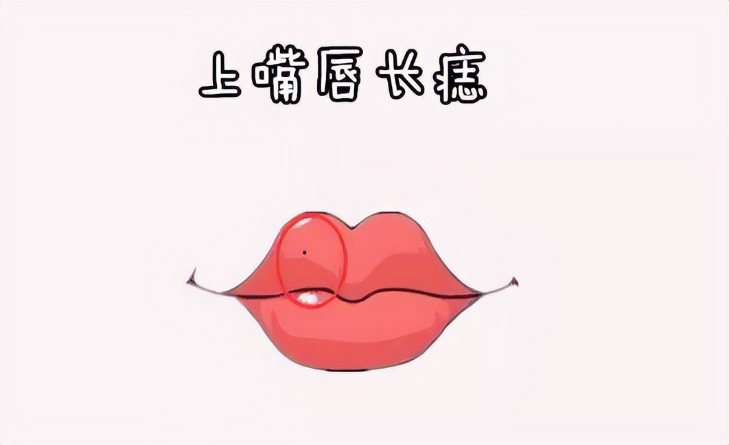 皮肤上的痣癌变是什么症状,出生就有的黑色痣会癌变吗