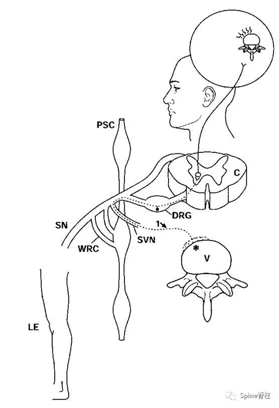 脊柱的神经支配,脊柱神经引起手臂疼痛