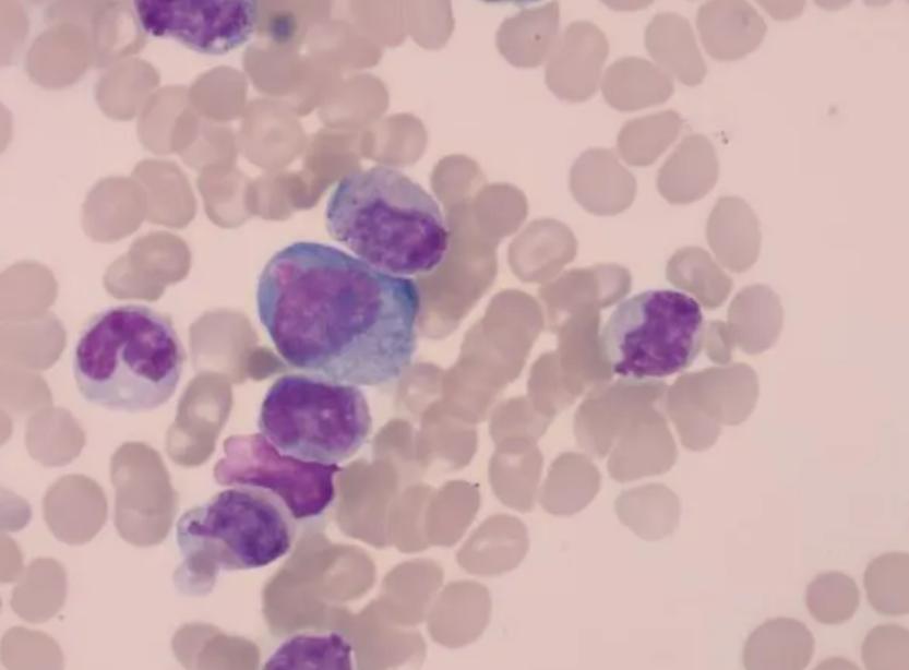 女性检查需要禁欲吗,已婚女性妇科必须做的体检