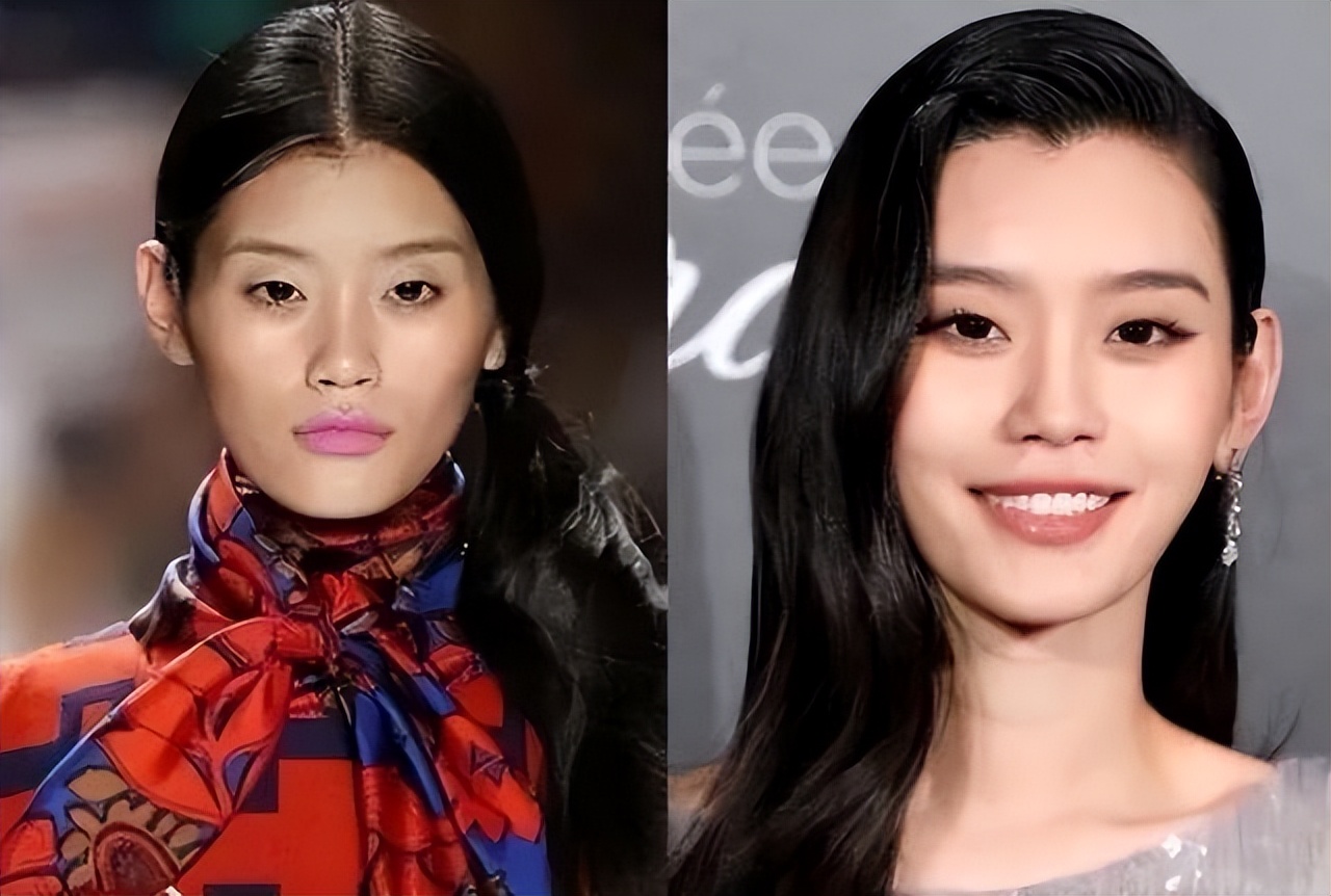 奚梦瑶整容了?鼻翼缩小,满满幼态,戴钻戒大秀恩爱