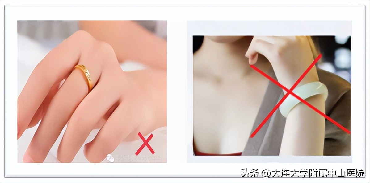 淋巴清扫后水肿怎么治疗可以康复,腋窝淋巴清扫后腋窝水肿处理方法