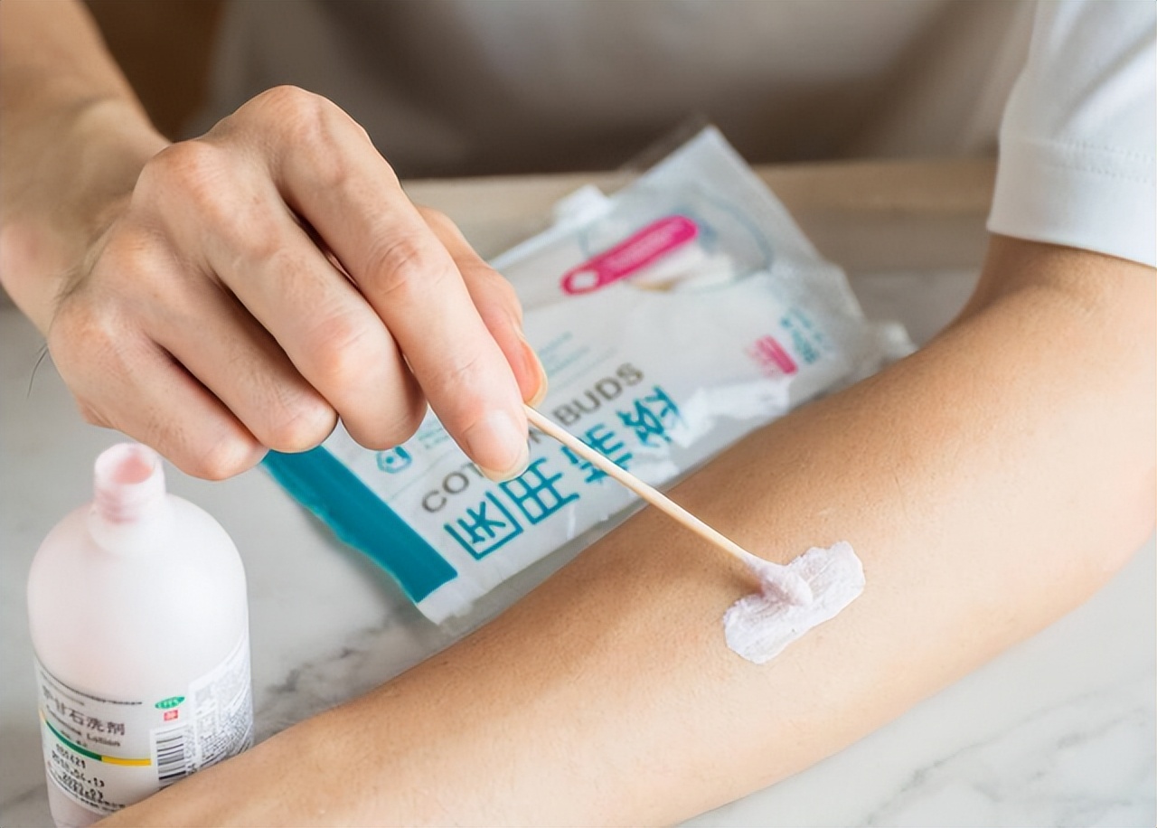 炉甘石洗剂功效多少钱一瓶,世卫组织推荐炉甘石