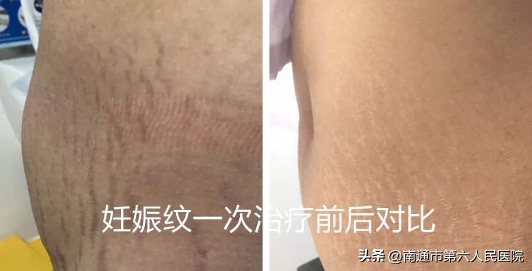 南通六院皮肤美容,南通附属医院皮肤美容科