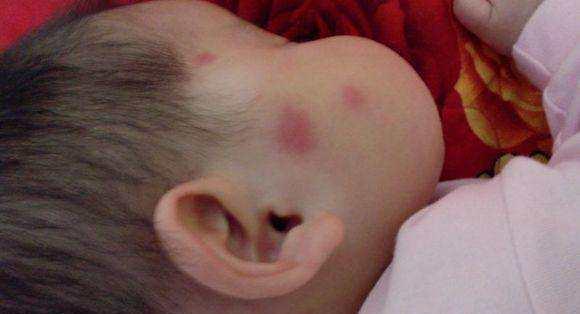 床上“螨虫成堆”？教你个土法子，家中放些它，螨虫“都跑光了”