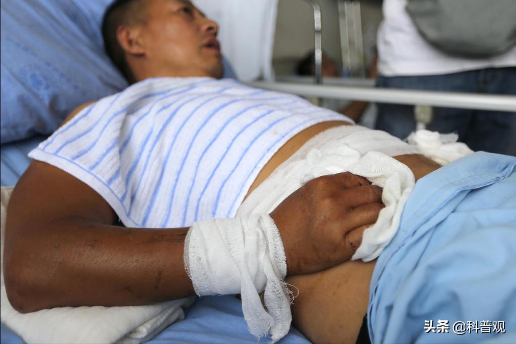 现实版“化骨水”！被标注为“弱酸”让人忽视，却能轻松蚀骨腐肉