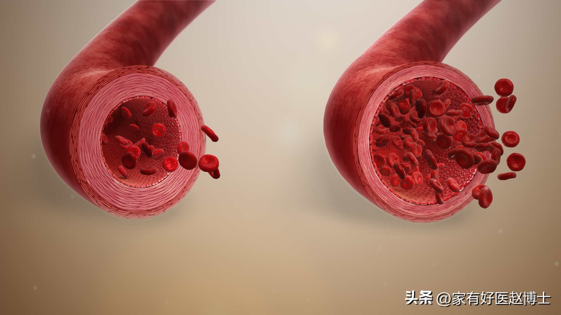 高血压脉压差大有什么危害,治疗老年脉压差大的中成药