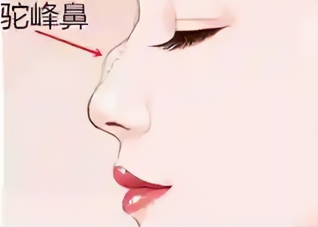 塌鼻子侧脸怎么变成高鼻梁p图,侧脸扁平没有立体感怎么拍照