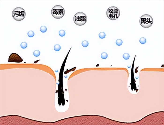 治疗毛孔粗大黑头的面膜,黑头用撕拉面膜毛孔粗大