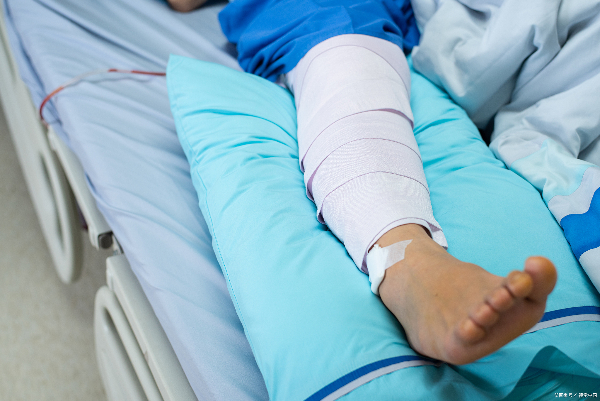 骨折之后吃哪些食物利于恢复,骨折后吃什么对骨折恢复有好处