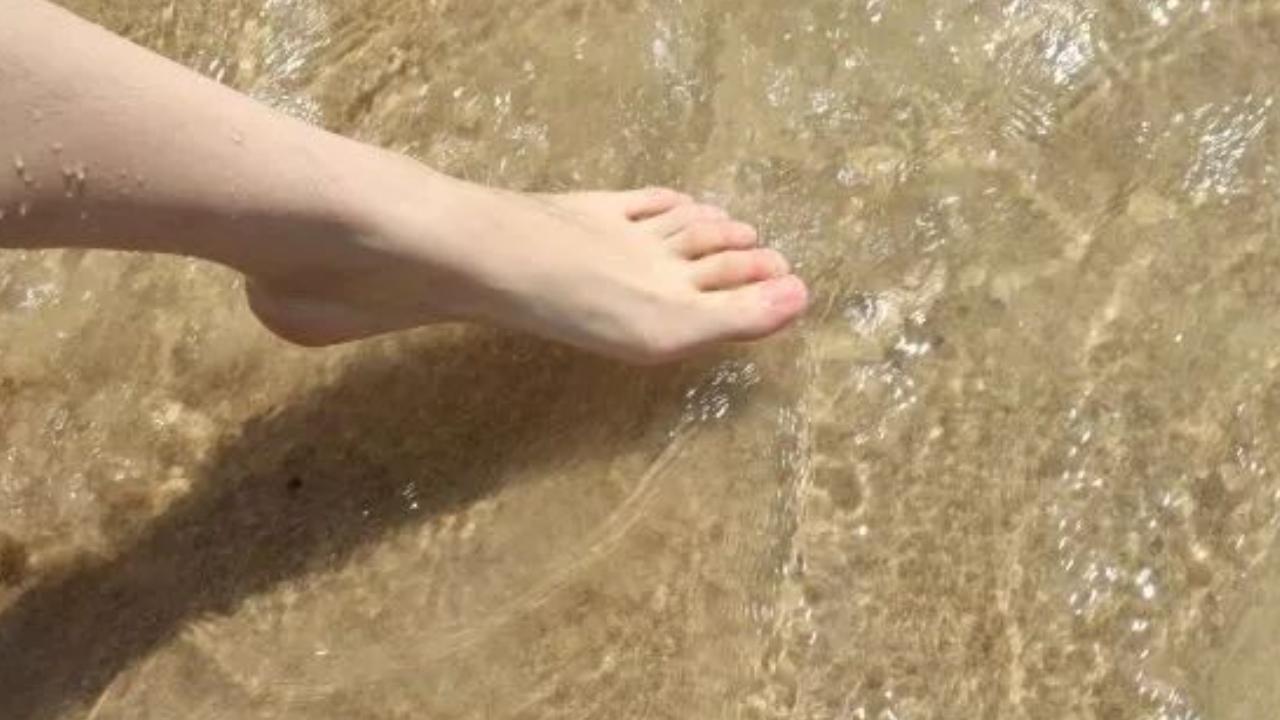 脚后跟干裂可能和这4个原因有关,脚后跟经常干裂什么原因