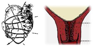 胎儿屁股在右侧是什么胎位,胎位roa屁股在左边还是右边