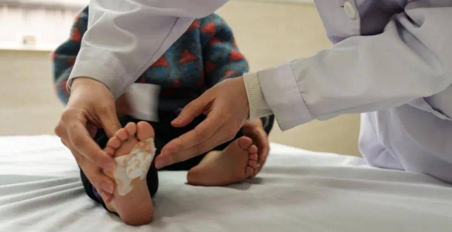 小孩反复感冒抵抗力差怎么办,孩子经常感冒抵抗力差怎么补