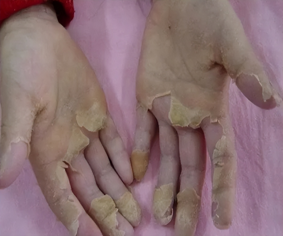 小儿舌头的各种症状如何解决,儿童舌头红色颗粒状怎么治疗