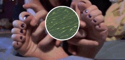 脚趾甲沟炎肿了涂什么药膏,小孩脚趾甲沟炎又红又肿怎样治疗