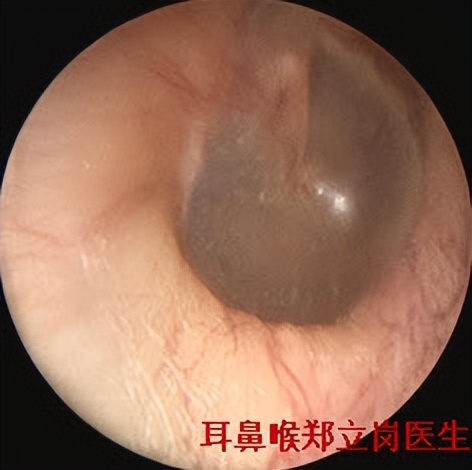 顽固眩晕，手术可治愈