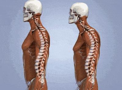 袁泉短发怎么减肥,袁泉瘦