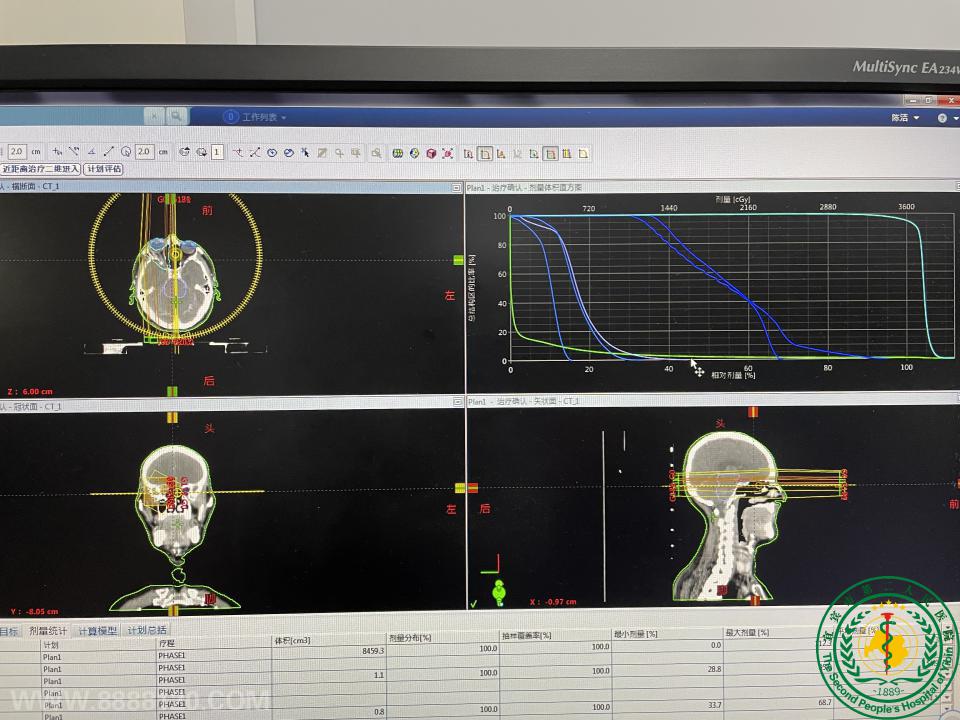 保全光明精益求精人性化治疗——宜宾市二医院与四川大学华西医院远程会诊