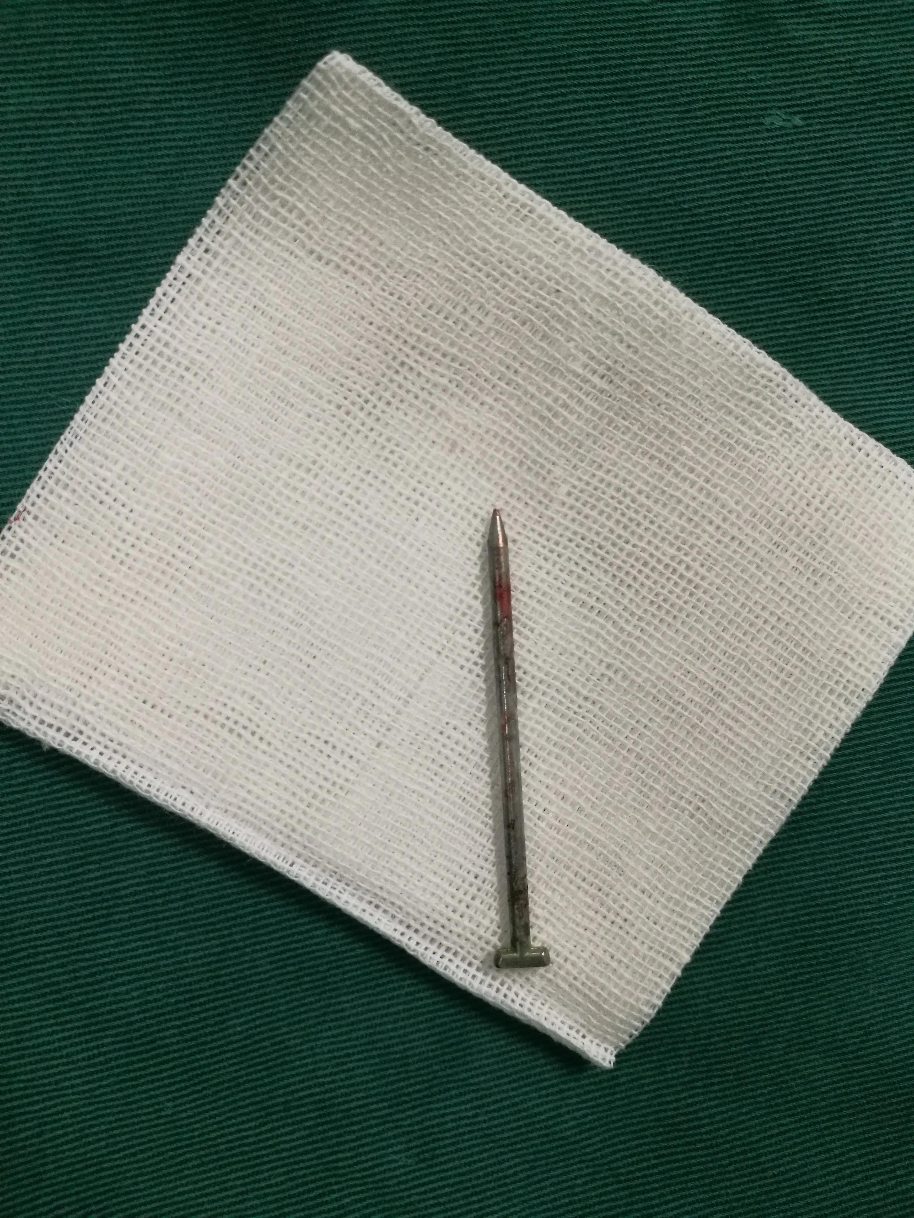 男孩往尿道塞近200颗“玩具球”，喜欢塞东西的熊孩子怎么回事