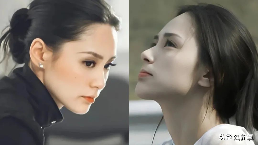 牙齿正畸和骨骼正畸的区别,牙齿正畸和眼轴增长有关系吗