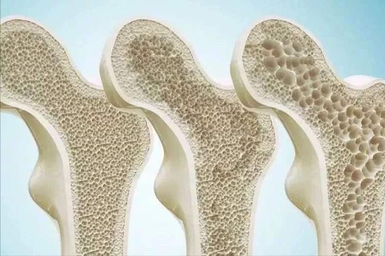 女人绝经的7个征兆是什么,女性绝经是好事还是坏事