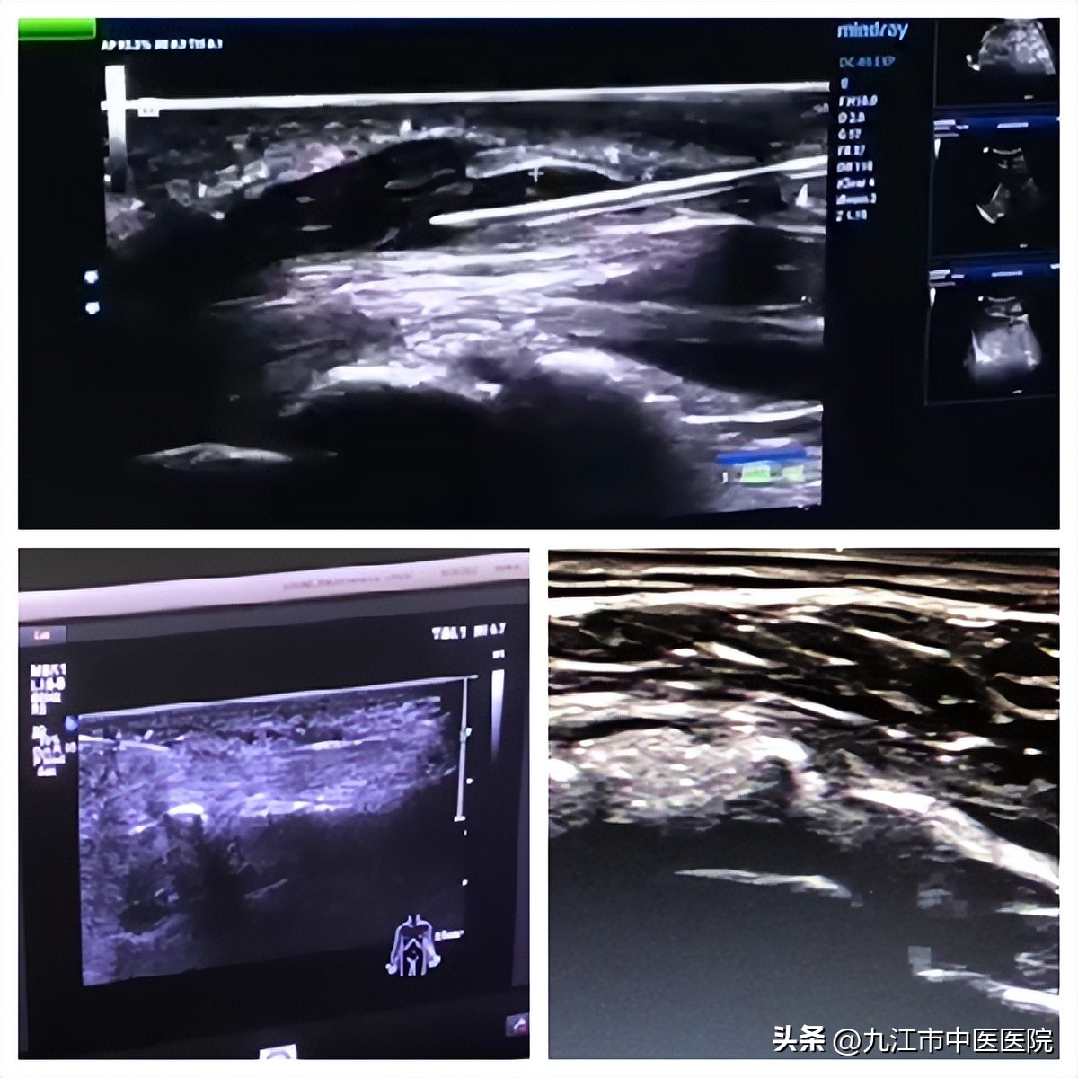 杏林春骨科,杏林春暖医院