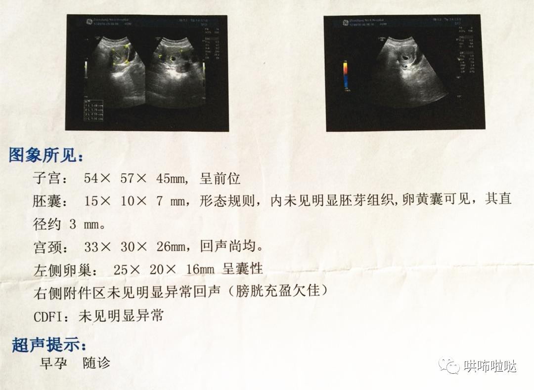 怀胎十月终于要卸货,回忆一下刚出生的宝宝