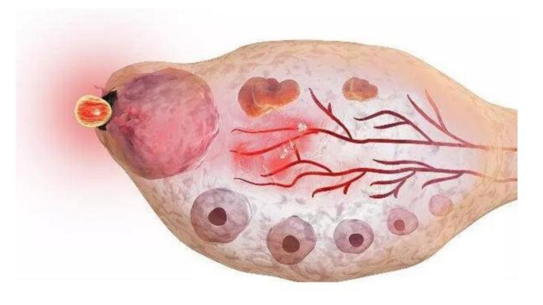 注意！性功能障碍不仅困扰男性，多数女性有苦说不出，该如何应对
