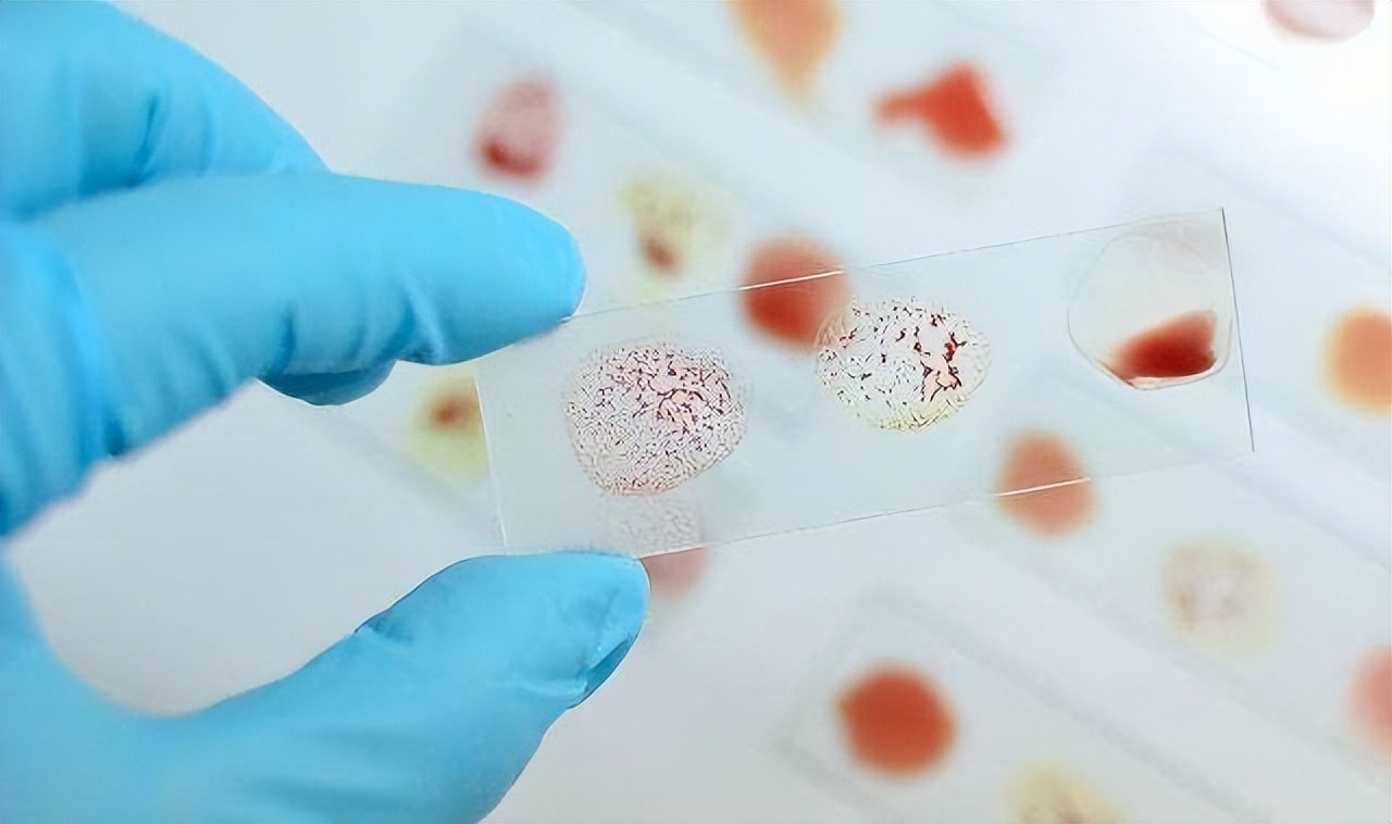 夫妻都是o型血生宝宝有什么问题,o型血夫妻生出来宝宝