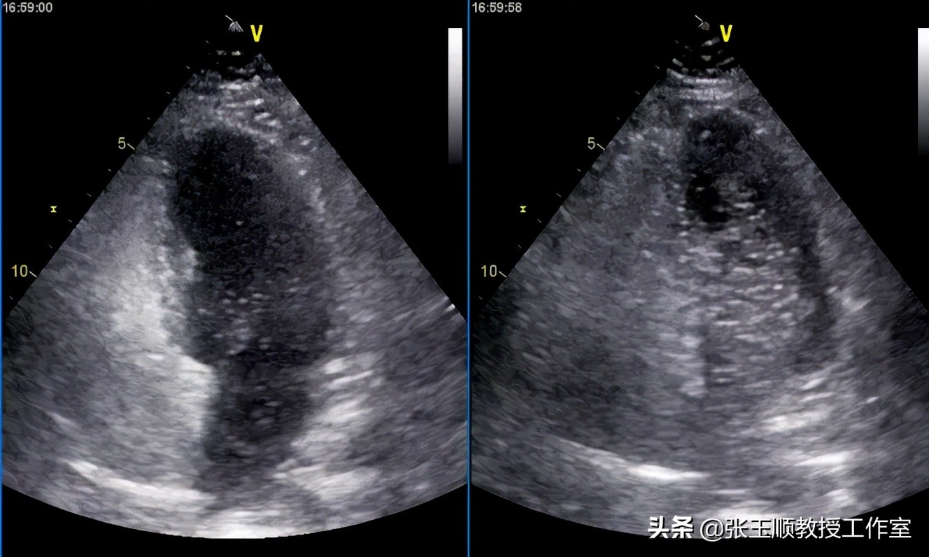 咳嗽不停该咋办导致晕厥,反复咳嗽一个月了是什么原因