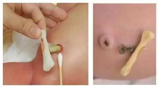 四个月宝宝体温37度5算发烧吗,10岁孩子37.5体温算发烧吗