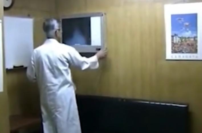 日本工人遭核辐射，被当白鼠强行续命83天，临终前烂成“烤全羊”