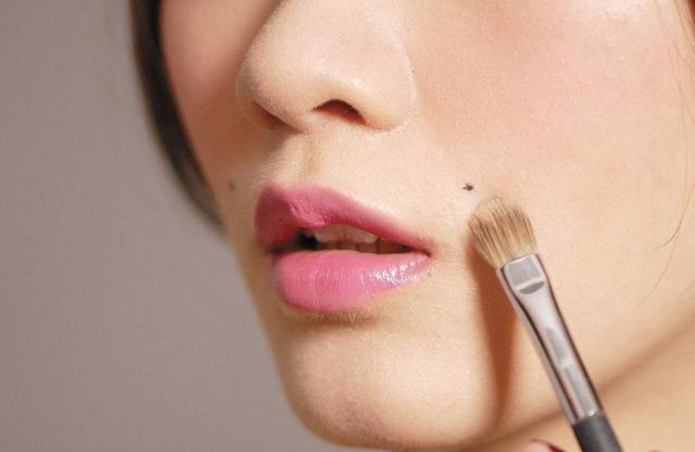 怎么在医院确定黑痣是不是良性的,黑痣隆起挂什么科检查