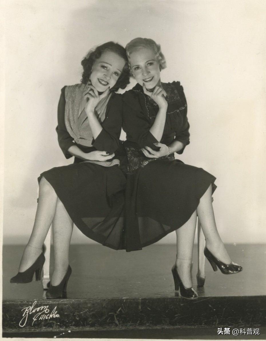 连体人一方死亡怎么办？妹妹去世后，连体姐姐被迫跟遗骸共同生活