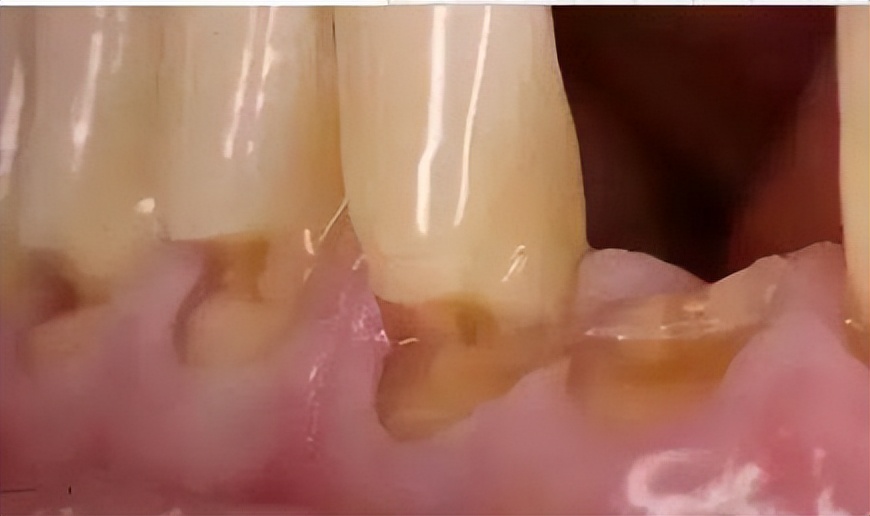 爱牙日正确刷牙的方式了解一下,全国爱牙日正确刷牙顺序宣传视频