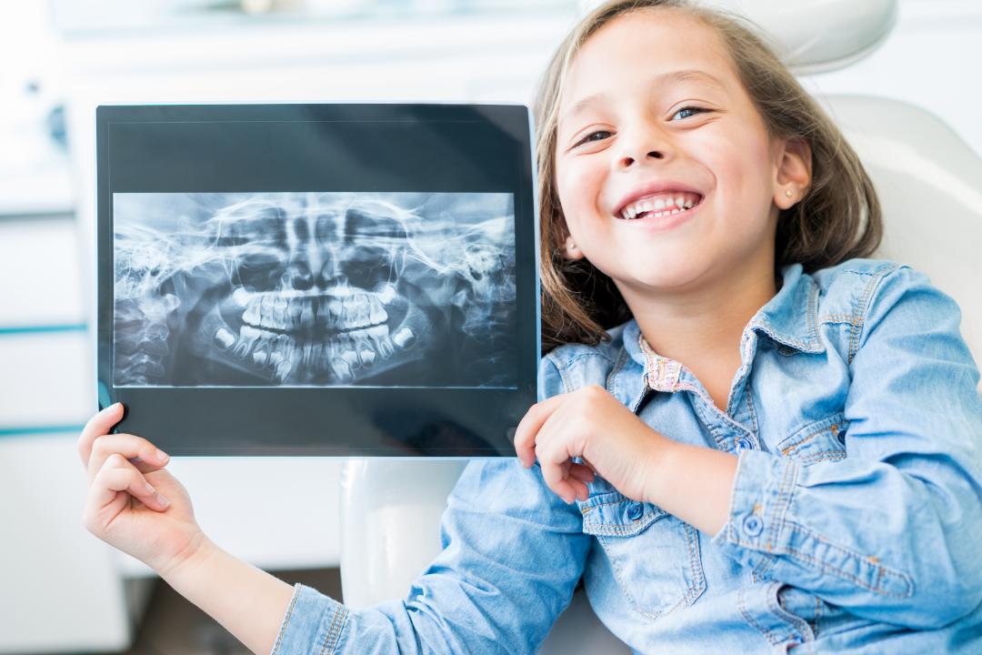 换牙期乳牙坏了要修补吗,乳牙坏了不就直接拔吗还补啥